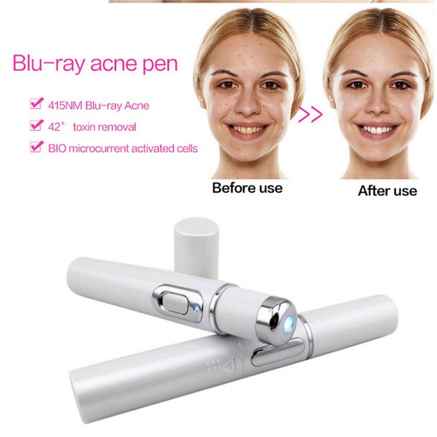 MOQ1  Wrinkle Blemish Pore Acne Scar Remover Pen
