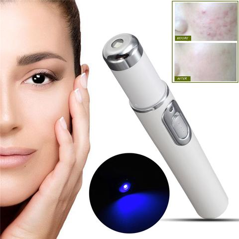 MOQ1  Wrinkle Blemish Pore Acne Scar Remover Pen